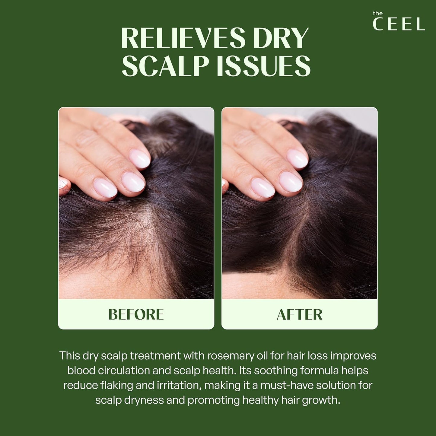 The Ceel Rosmarinöl Haare, 50 Ml, Haaröl Wachstum Mit Biotin.